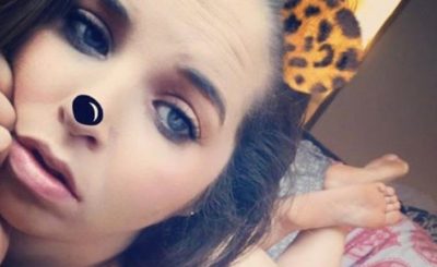 Co to jest lipodemia?Jak i gdzie gromadzi się tłuszcz? Lipodemia to rzadka choroba o której mało kto słyszał. Raylynn cierpi na nia od dziecka.