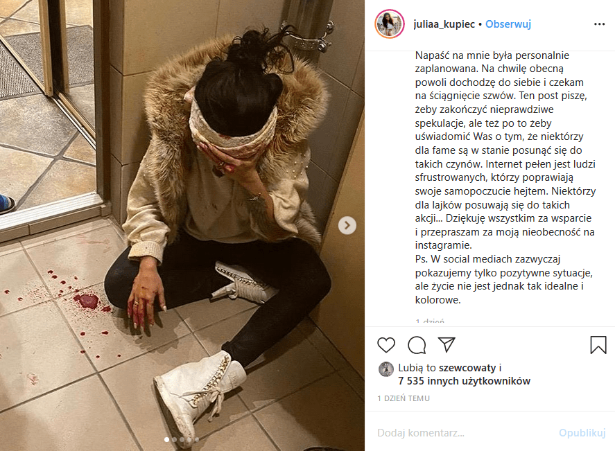 Julia Kupiec, gwiazda TTV, została zaatakowana i pobita, wręcz skatowana, ale dokładnie nie wiadomo przez kogo. Zdjęcia Kupiec na Instagram wstrząsjają.
