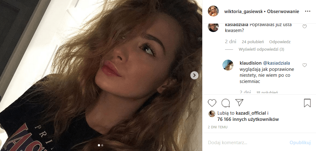 Wiktoria Gąsiewska, znana z Rodzinka pl, wstawiła zdjęcie na Insta, od razu została oskarżona o to, że przeszła operacje plastyczne: ma powiększone usta?