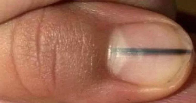 Makijażystka zauważyła skazę na paznokciu klientki. Jej reakcja uratowała życie kobiecie