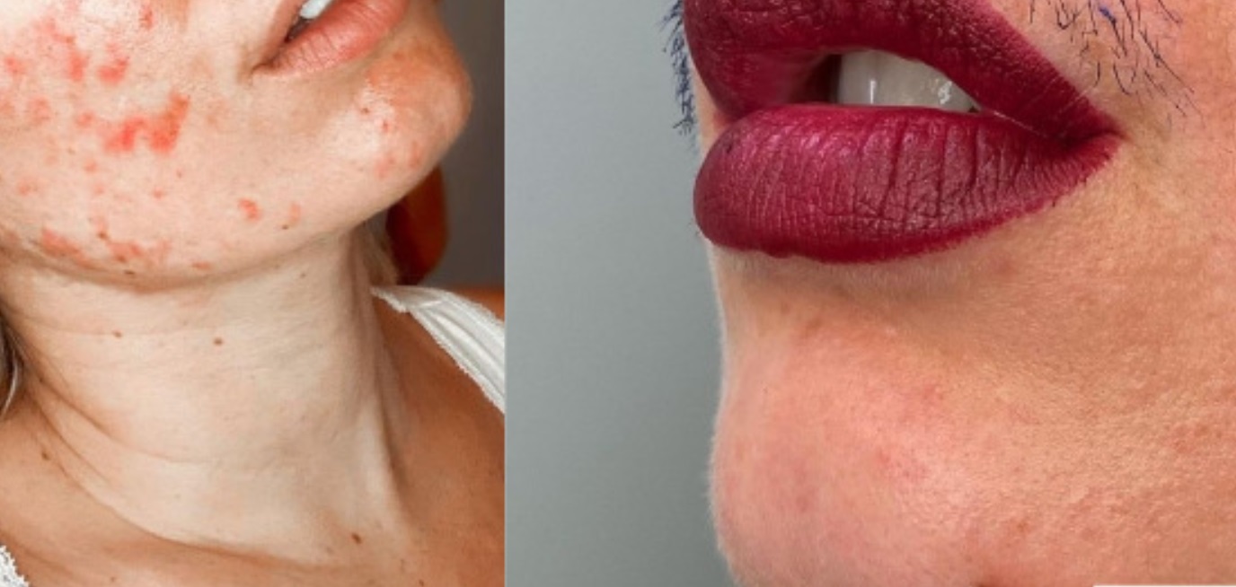 Joanna Kenny to kosmetyczka, która zdecydowała się na odważny na Instagramie krok po tym jak zaczęto na nią wołać "kobieta z wąsami".