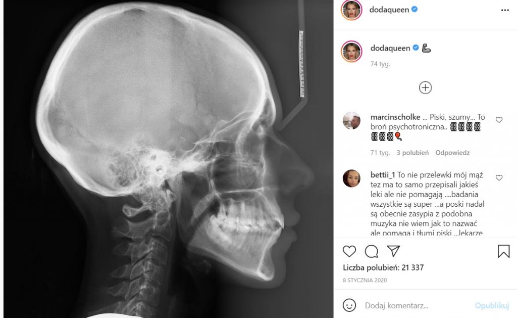 Doda ( zespół Virgin) i jej operacja plastyczna to oszczerstwa, Rabczewska około roku temu na Instagram informowała jest chora. 