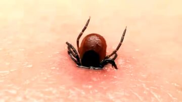 Skuteczny sposób na kleszcze, o którym nie miałeś pojęcia. To prawdziwy hit!