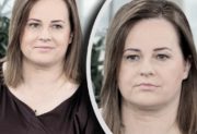 Kołaczkowska walczy o zdrowie. Tymczasem głos zabrała lekarka