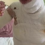 Dwa lata po dramatycznym wypadku Maja Kuczyńska ponownie zwróciła uwagę internautów. Influencerka opublikowała zdjęcia w bikini